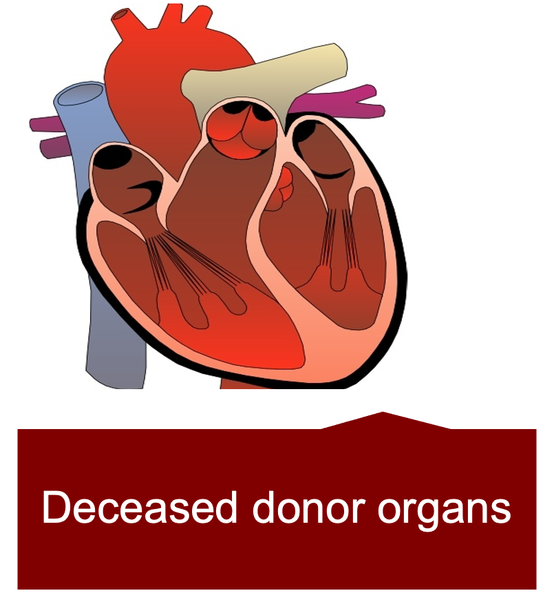 Deceased donor organs